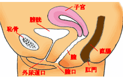 骨盤腔内の断面図と膣の縮小部位