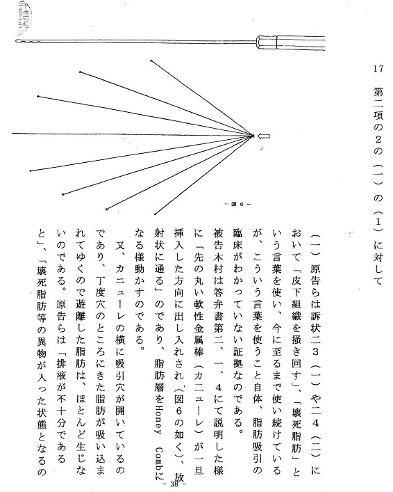 脂肪吸引のカニューレの動かし方