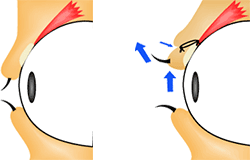 二重になると、なぜ目が大きくなるのか