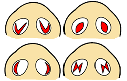 鼻翼縮小内側法