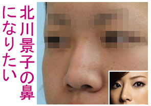 北川景子の鼻に整形したい １ 美容外科ヤスミクリニック