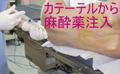 硬膜外麻酔とは何ですか?