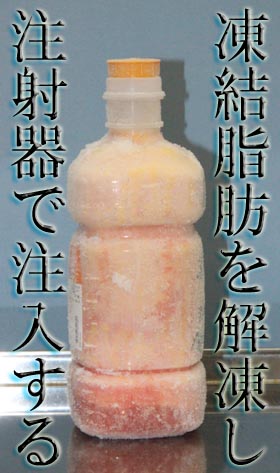 凍結脂肪の(解凍後)注入